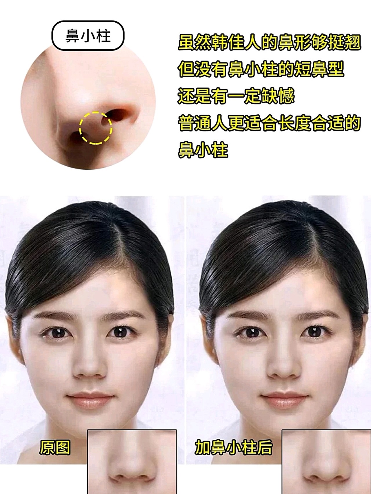 大家都知道以韩佳人为代表的韩式小翘鼻以前有多火吧,除了韩佳人,闵