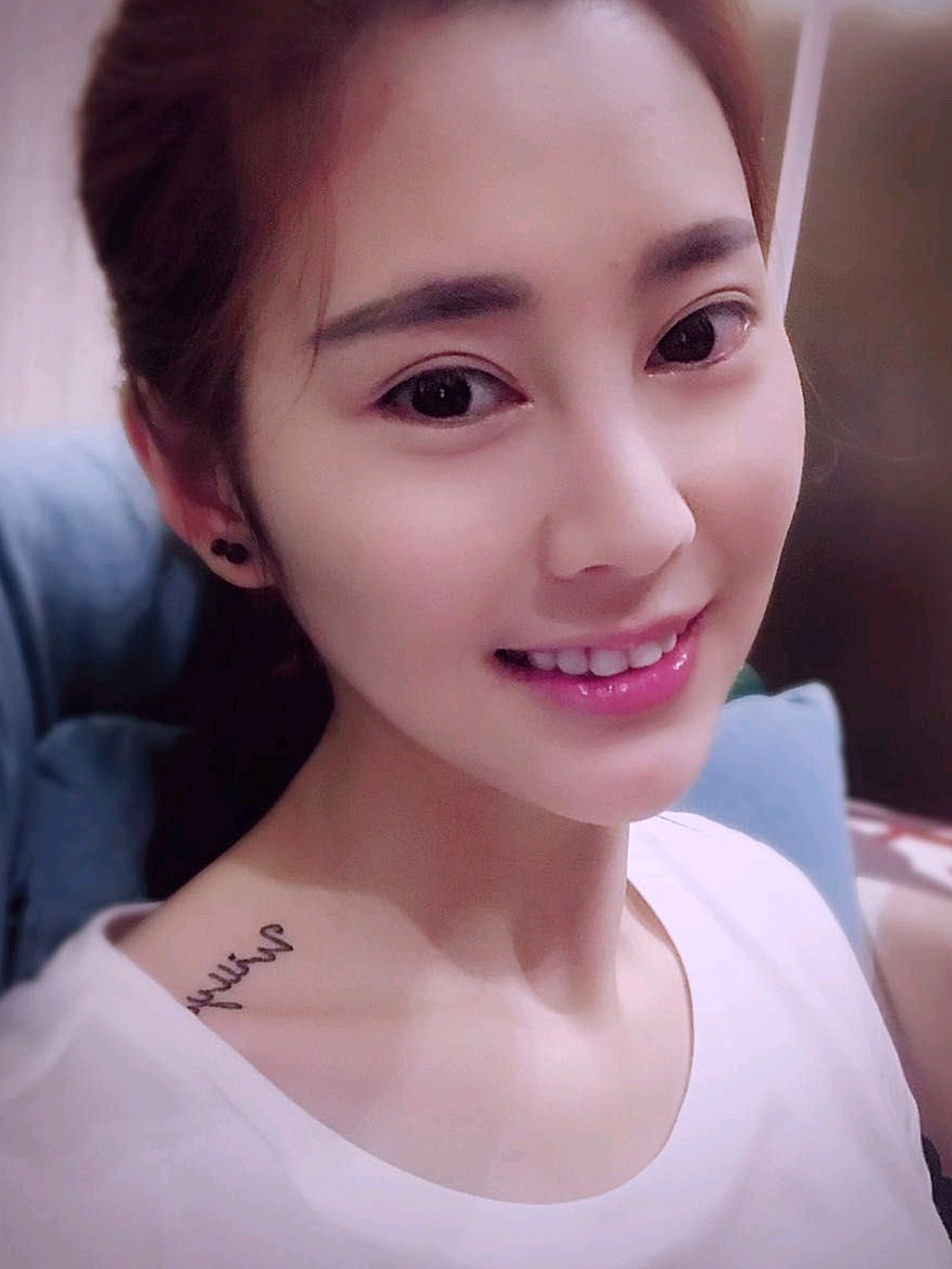 99夏天割双眼_圈子-新氧美容整形