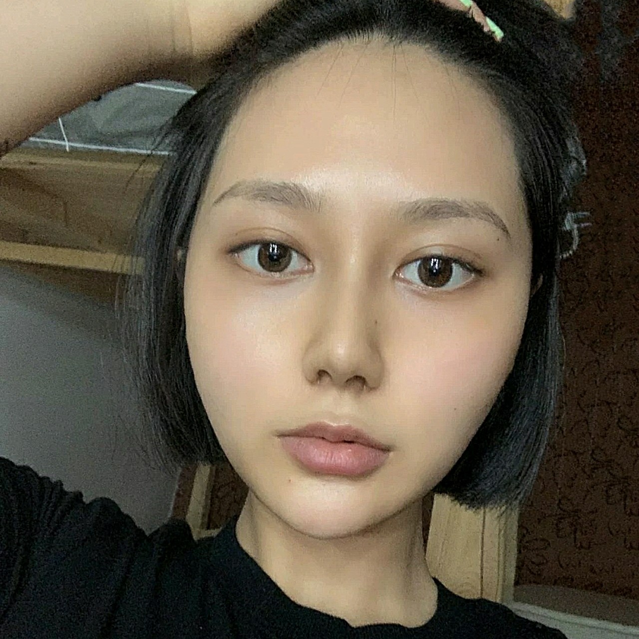 耳软骨鼻部多项术后,现在鼻子越来越自然了,变美就是需_圈子-新氧美容