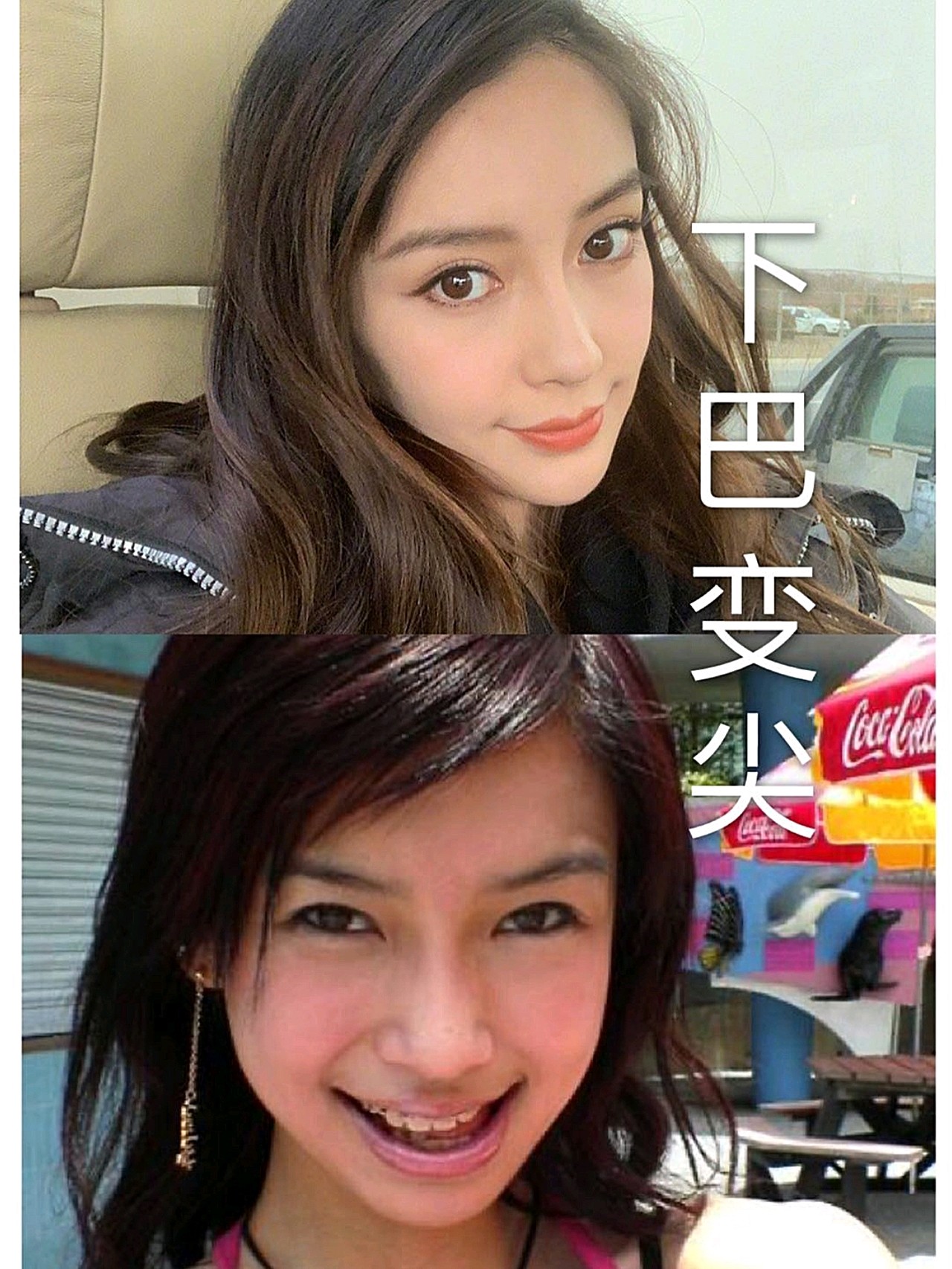 网友明星下巴后缩对比照片正颌前后明星angelababy正颌前后下巴对比图