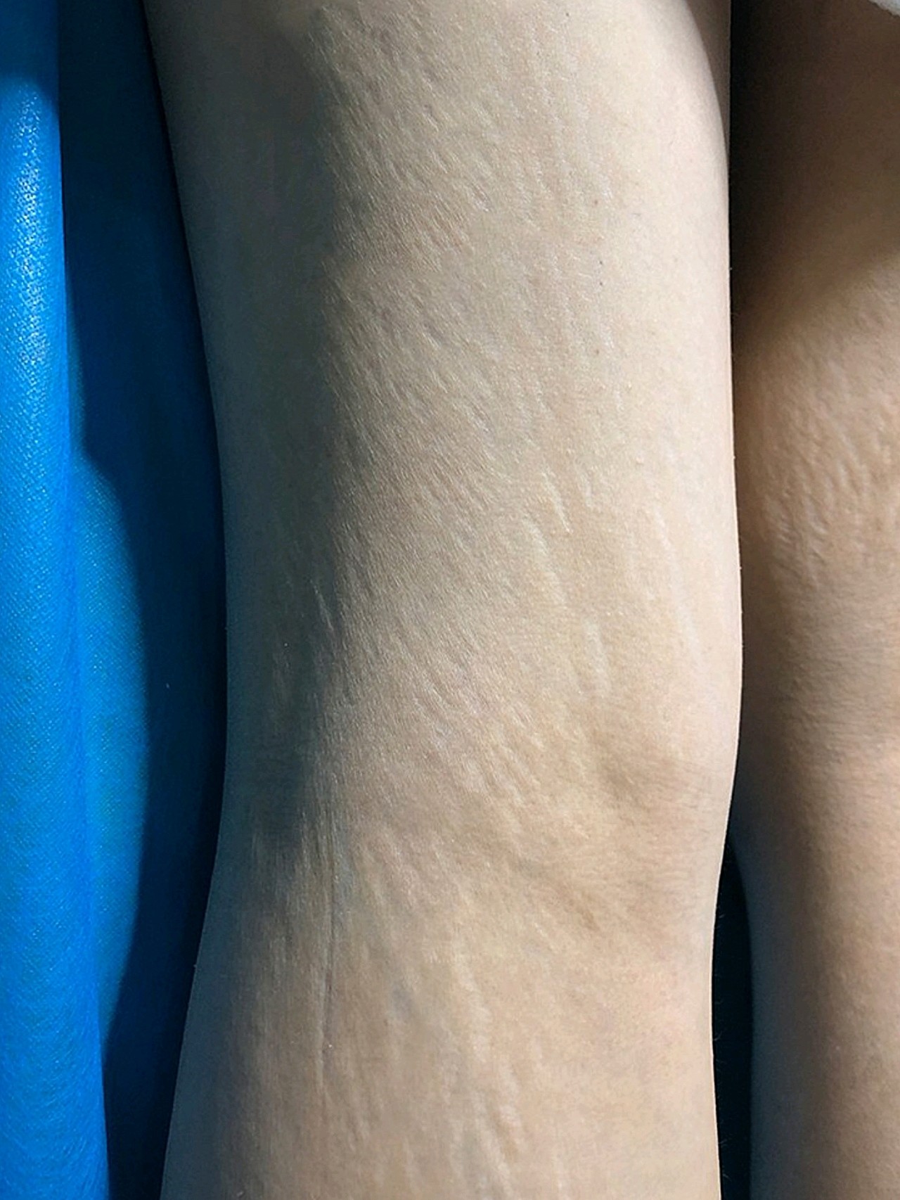 效果比较满意,费用透明,设施,设备健全,环境优美,_圈子-新氧美容整形