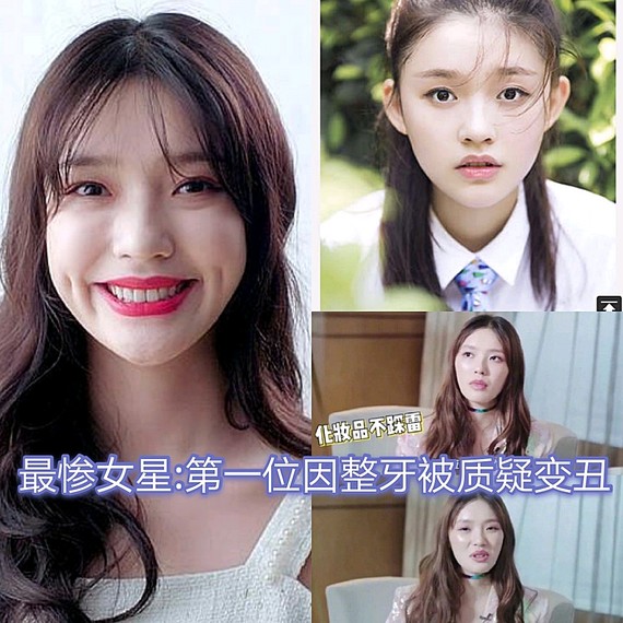 林允作为星女郎_圈子-新氧美容整形