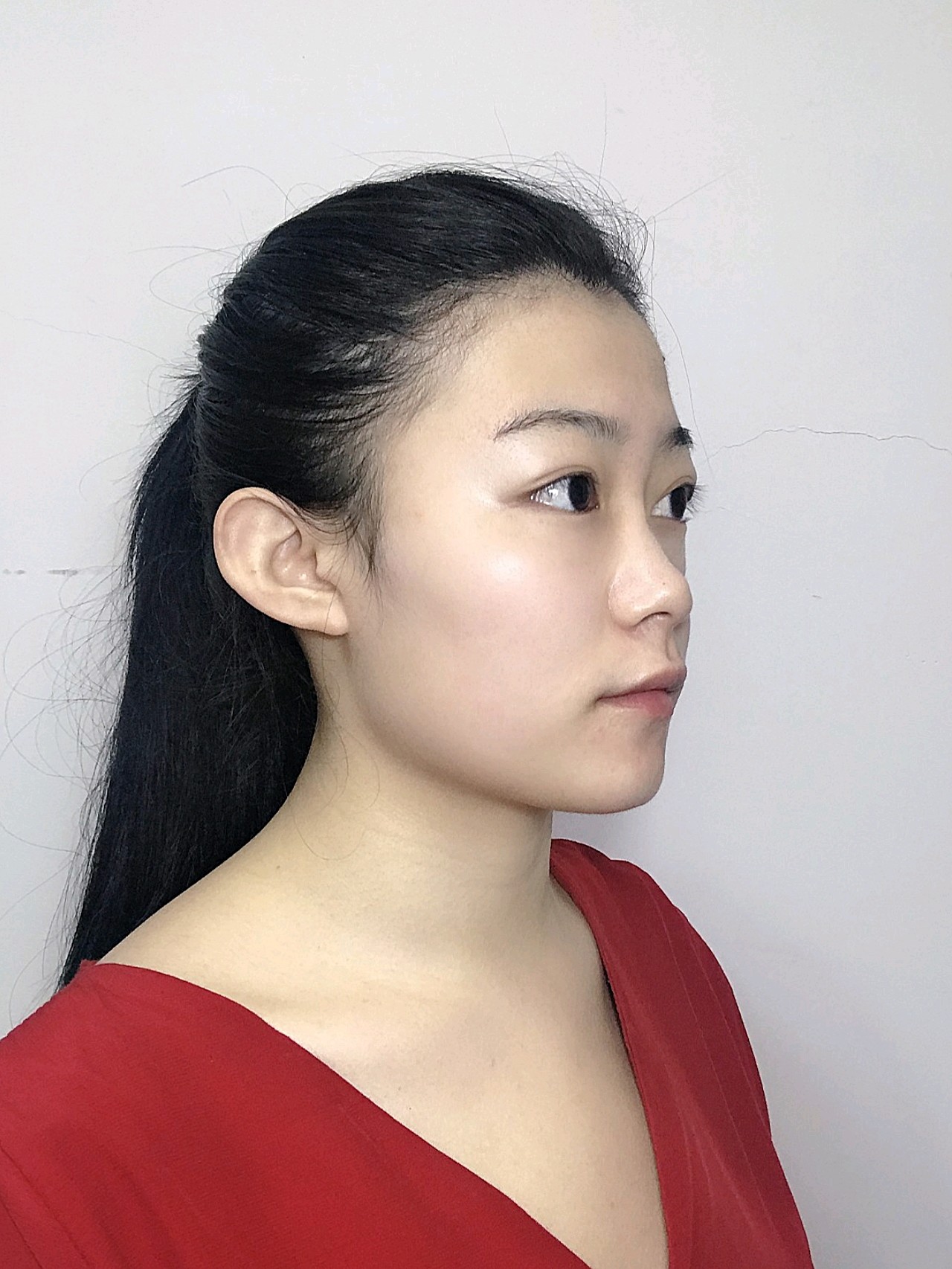 看着舒服的鼻子 有高度 又自然