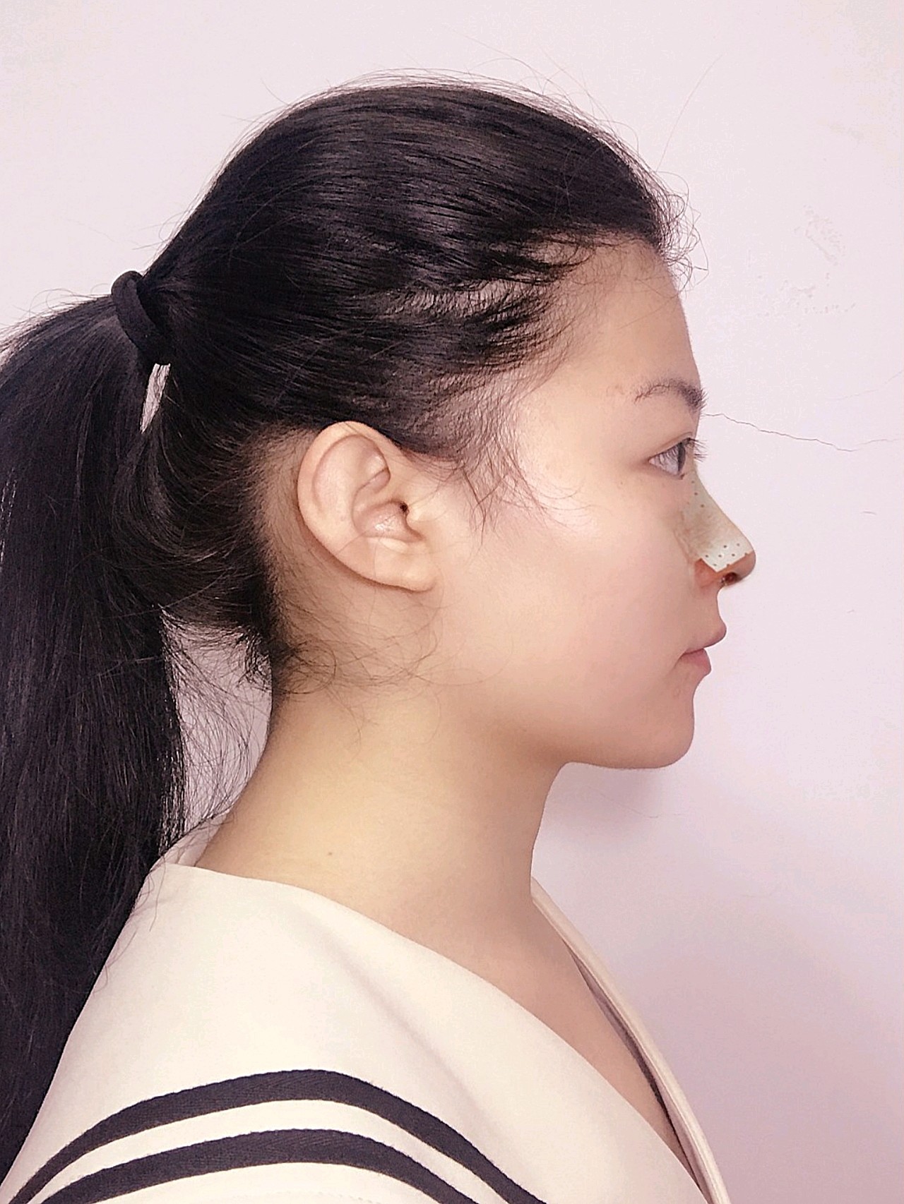 看着舒服的鼻子 有高度 又自然