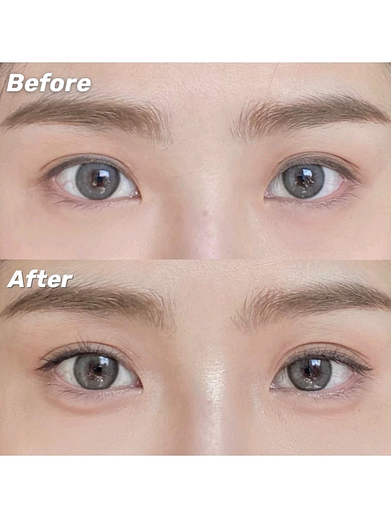 的整容案例 卧蚕的阴影每个人适合的大小都不一样要在画之前找准范围