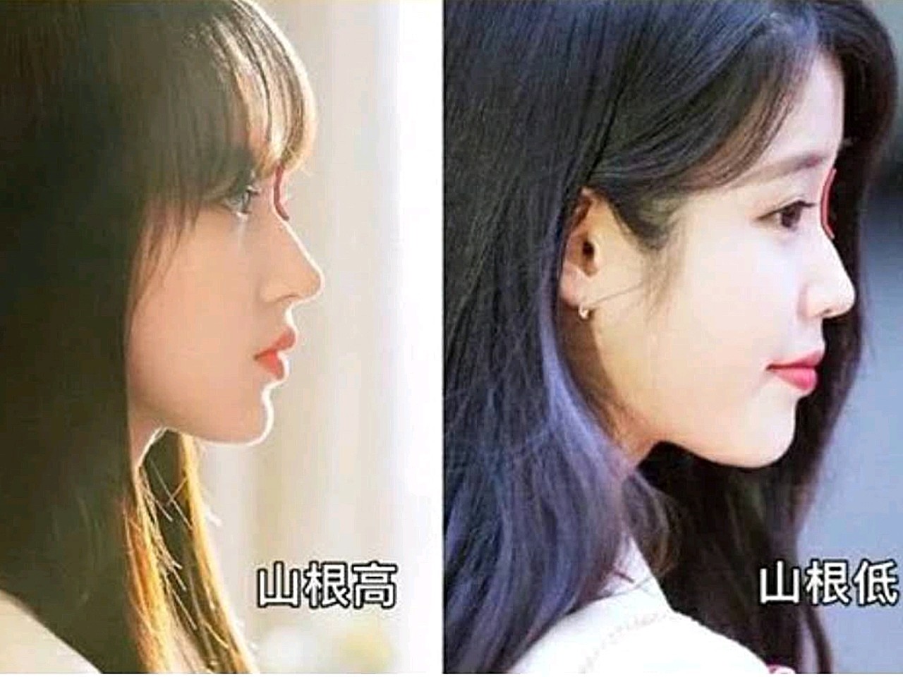 "好看的鼻子要从山根开始",而决定山根美丑的还有另外两个关键点:山根