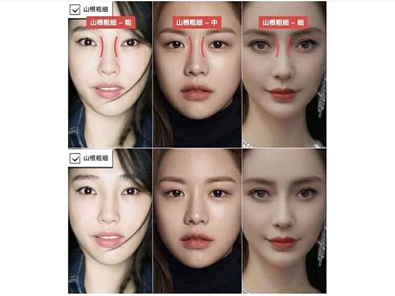 "好看的鼻子要从山根开始",而决定山根美丑的还有另外两个关键点:山根