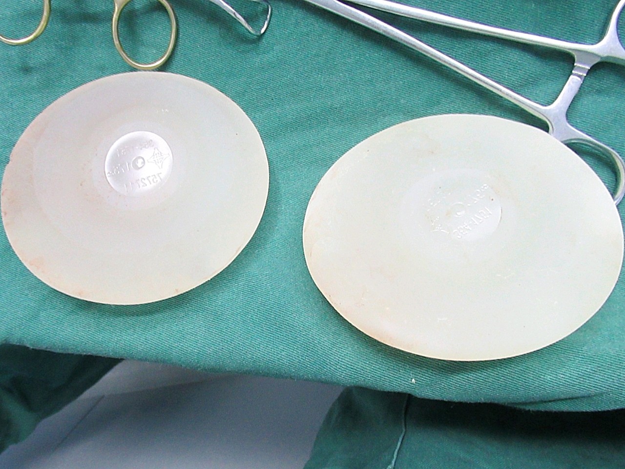 这次把胸里的假体取出来,快十年了,有点下移和明显了_圈子-新氧美容