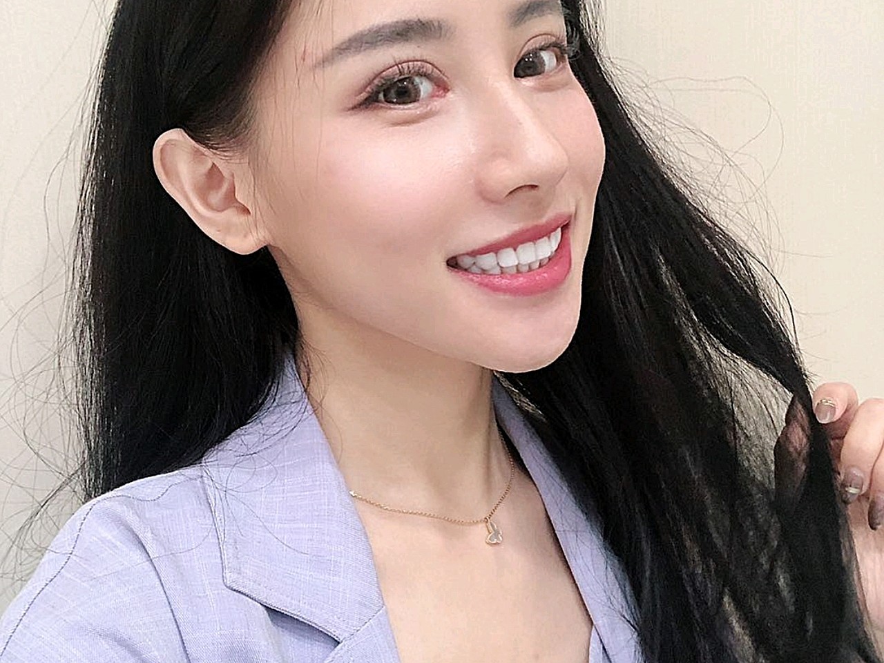 好神奇,贴完牙齿整齐了,而且白的让我更加爱笑了,牙_圈子-新氧美容