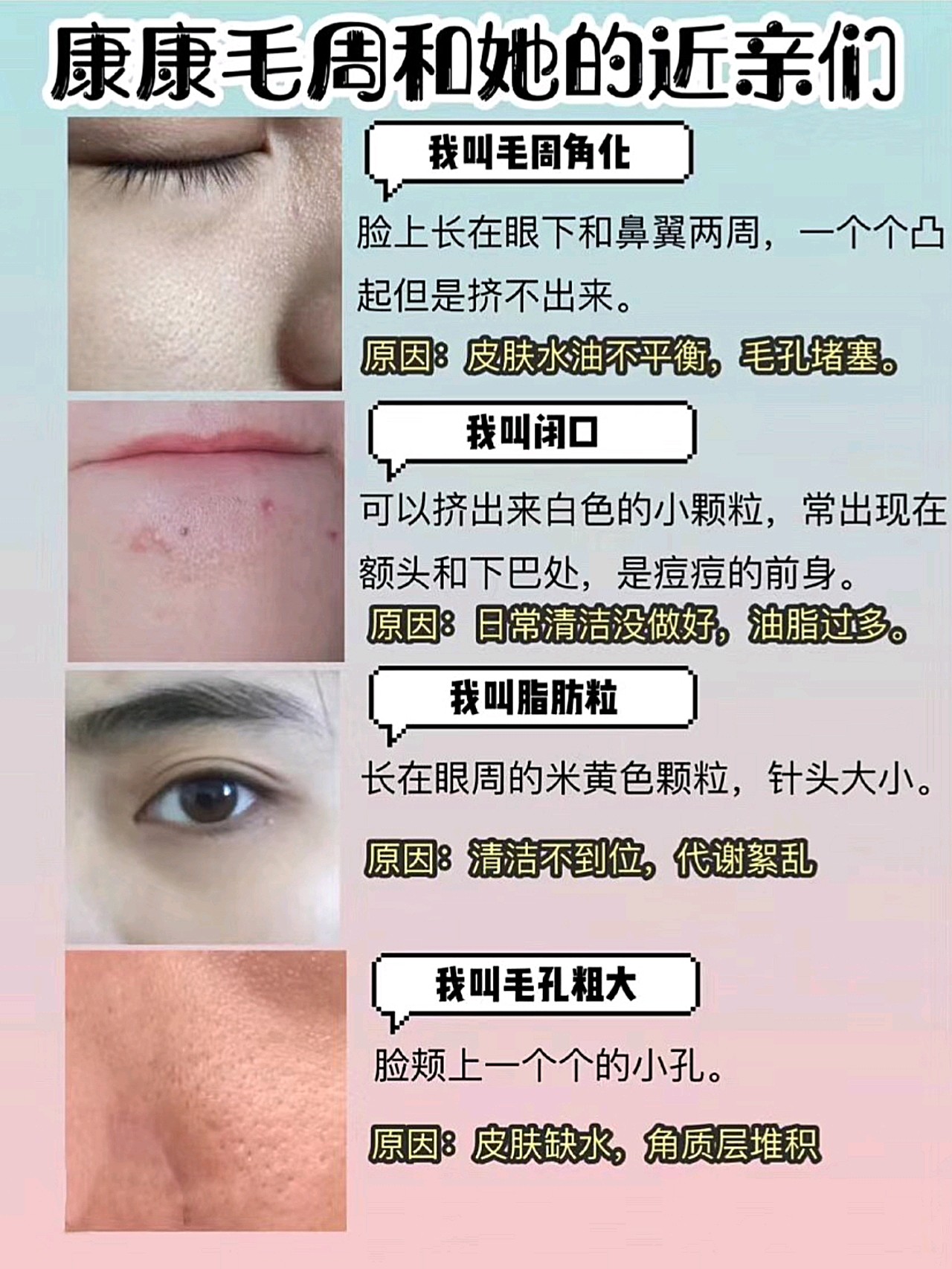 毛周角化与闭口有什么区别