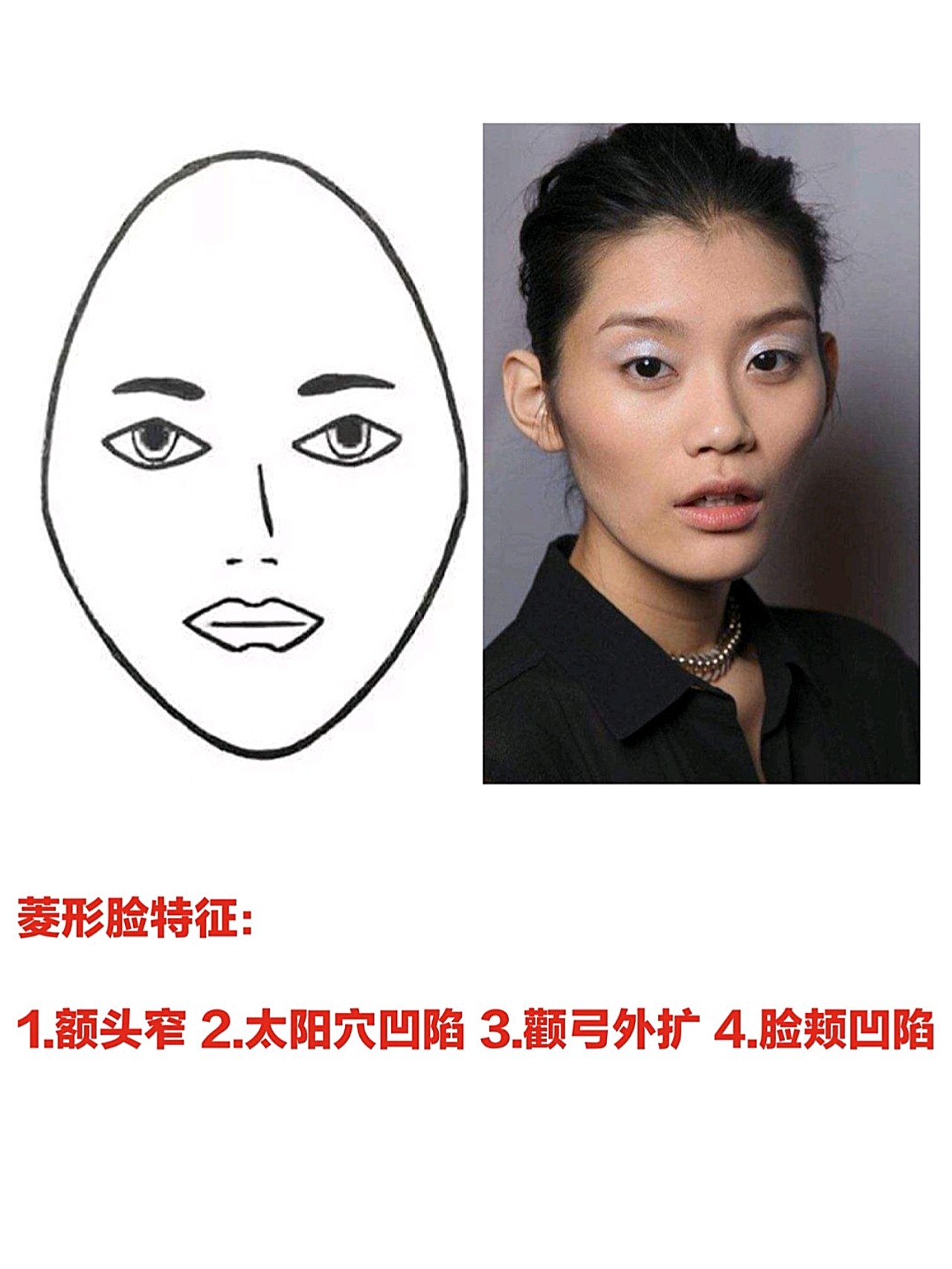 全脸自体脂肪填充