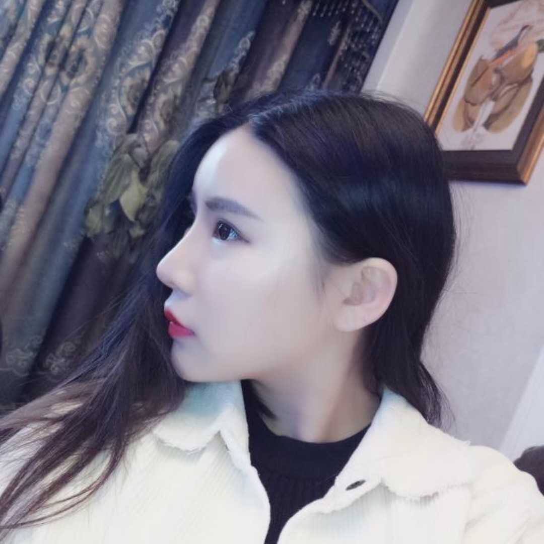 虽然我不是天生的小翘鼻,但是经过后天的改造还是非常自然的.
