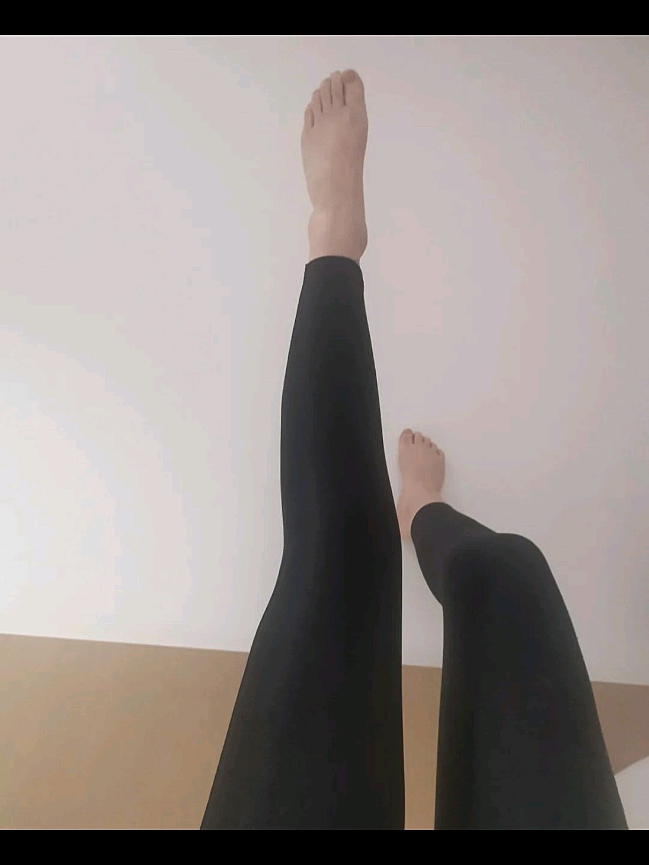 【沈阳汇美人大腿吸脂第31天】大腿根从63-51,_圈子-新氧美容整形