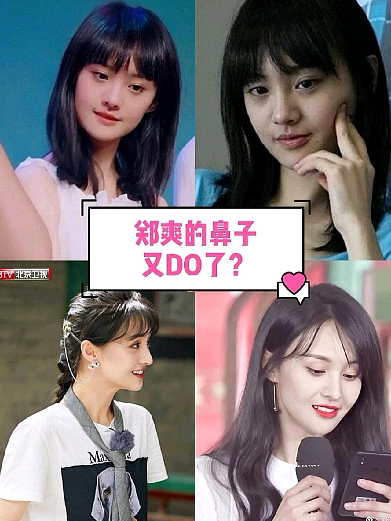 但现在郑爽的鼻子好像越来越不自然了,鼻尖