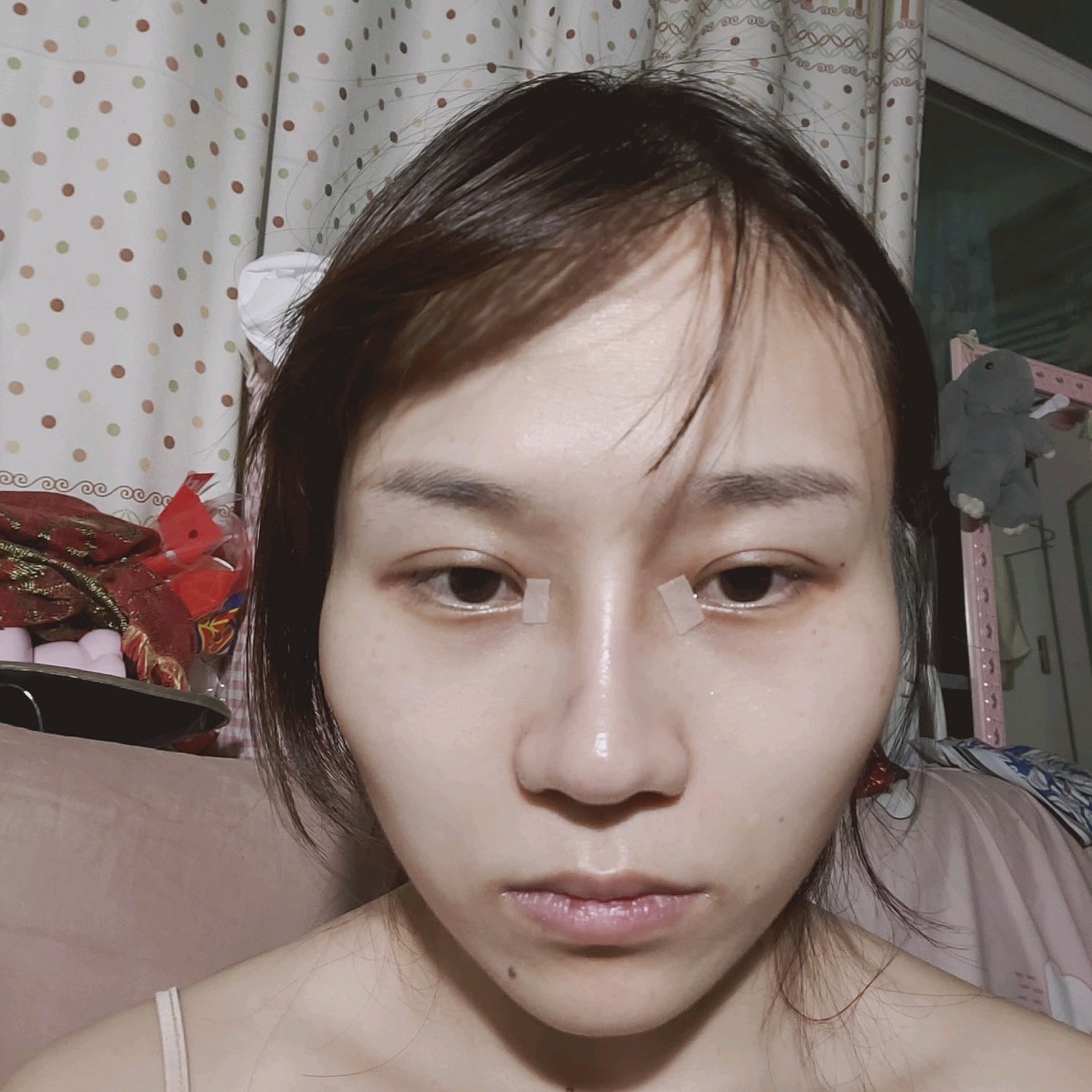 请问肋骨鼻梁太窄和鼻头不搭怎么办?