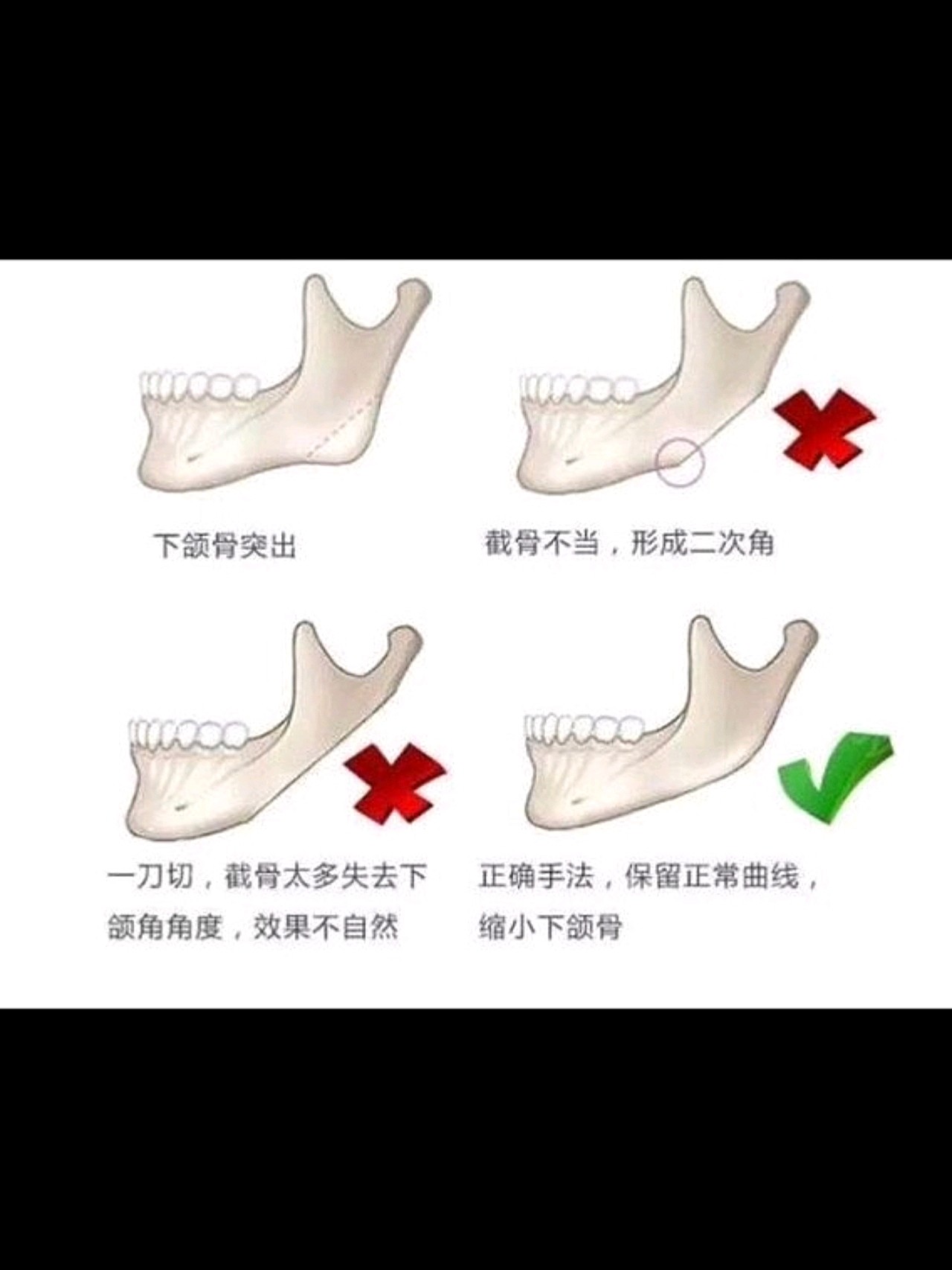 拥有完美下颌骨下颌骨是哪里71