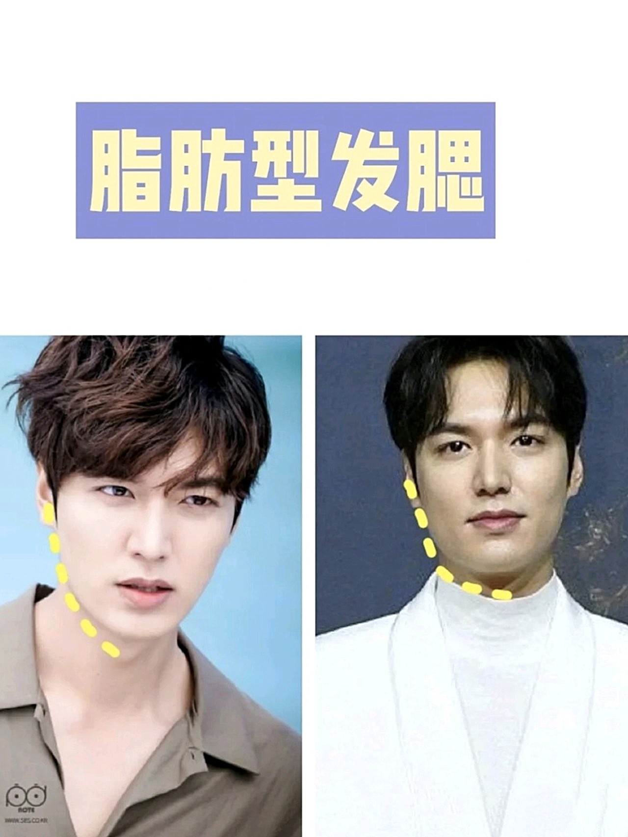 "发腮"杀伤力有多大?颜值下滑太恐怖了!