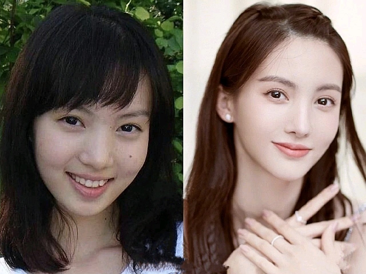 这些明星缩小完鼻翼,令人窒息过度缩小鼻翼,小心变成_圈子-新氧美容