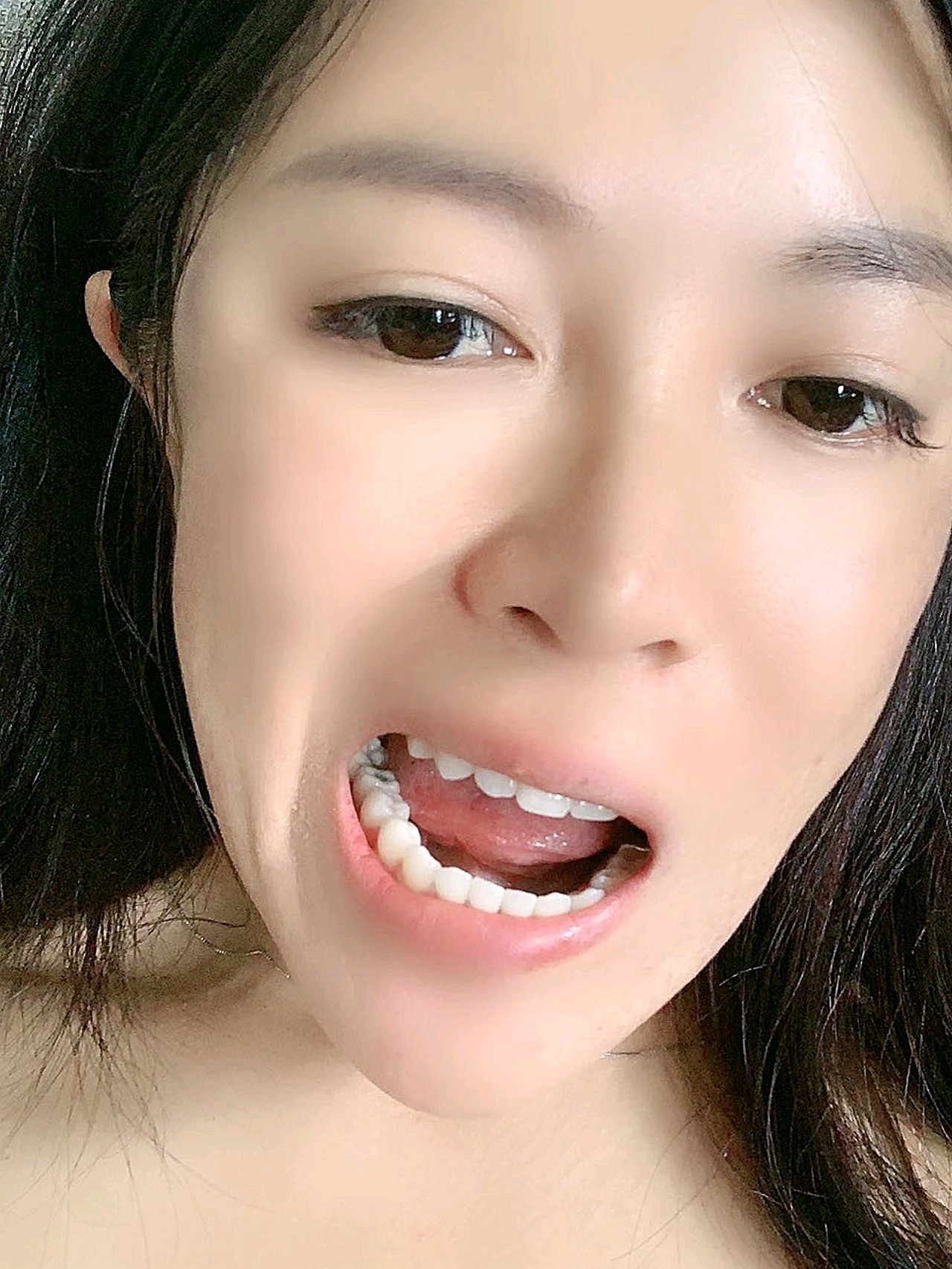 牙已经完完整整的在我的嘴里了,张嘴给你们看看,感觉和其他牙齿差不多