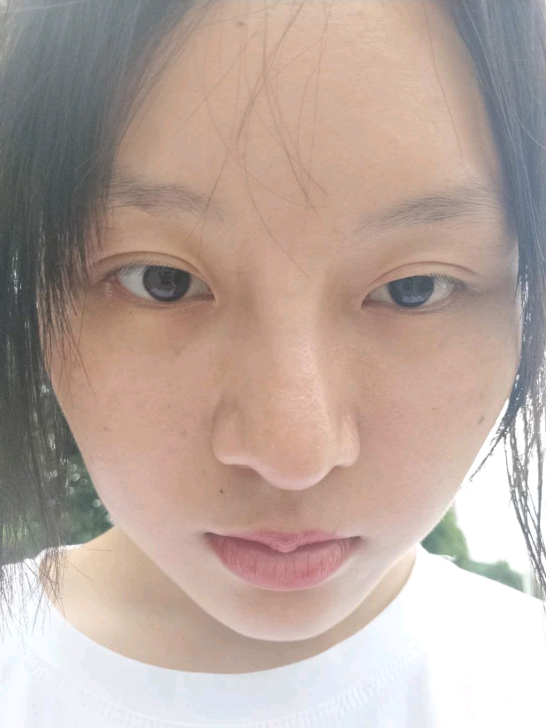耳软骨隆鼻第十五天鼻子歪了正常吗 新氧 专业医美服务平台