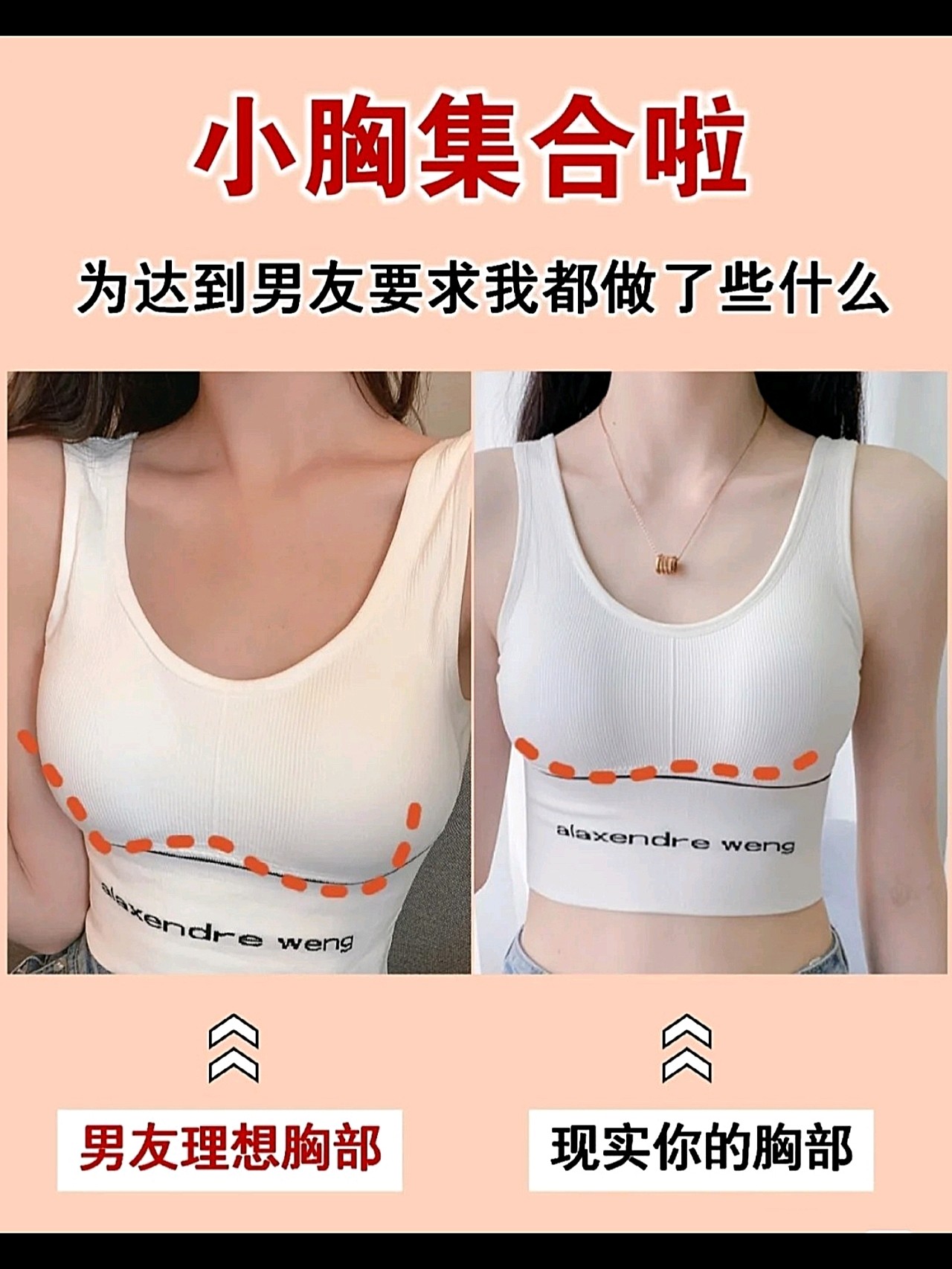 平胸|_圈子-新氧美容整形