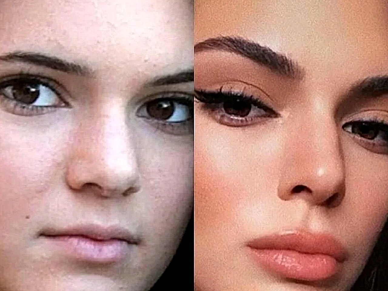 0很多人都说kendall是欧美教科书般的整容审美,不多不少,成就了今天她