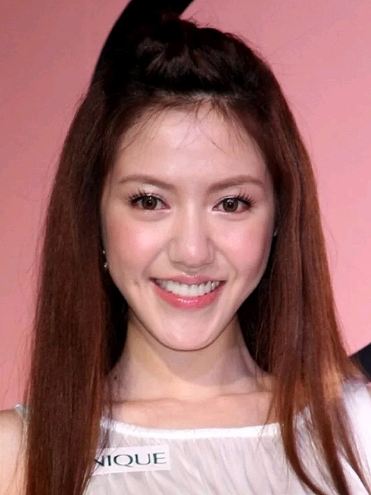 41岁长成18岁的模样,秘诀是啥7171整容比baby_圈子-新氧美容整形