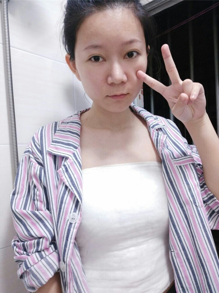 【假体隆胸第4天】今天的活动力度大点了,胸部没那么_圈子-新氧美容