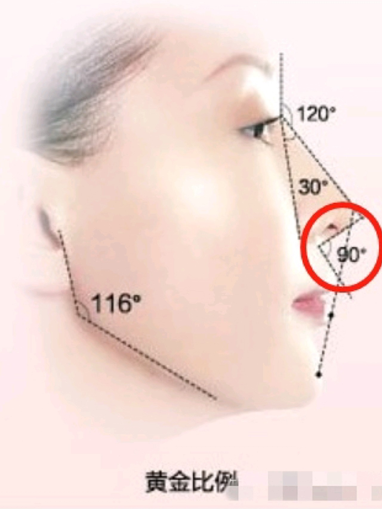 凸嘴的人都有什么烦恼?