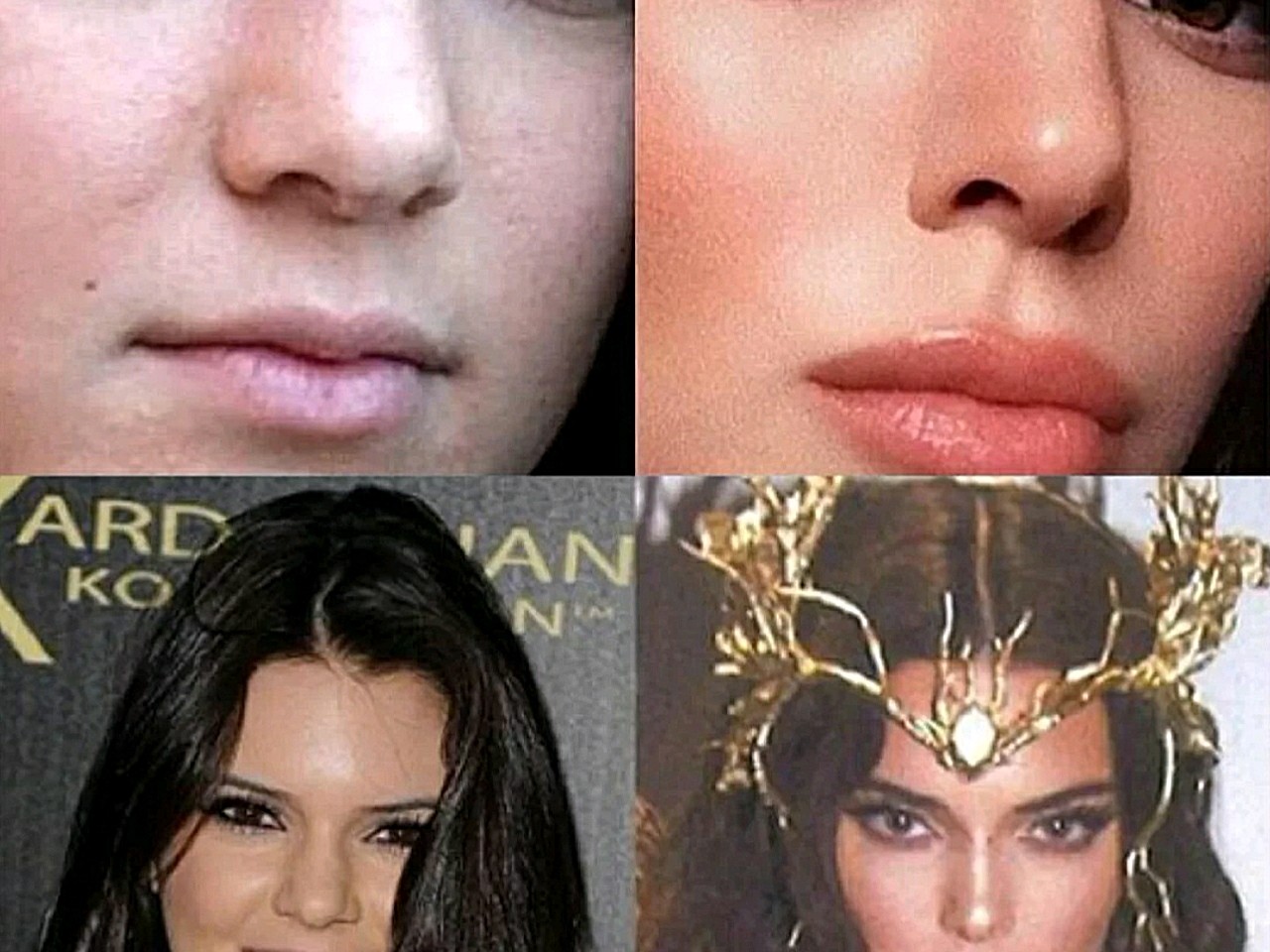 没想到肯豆的颜和身材也都是整出来的!