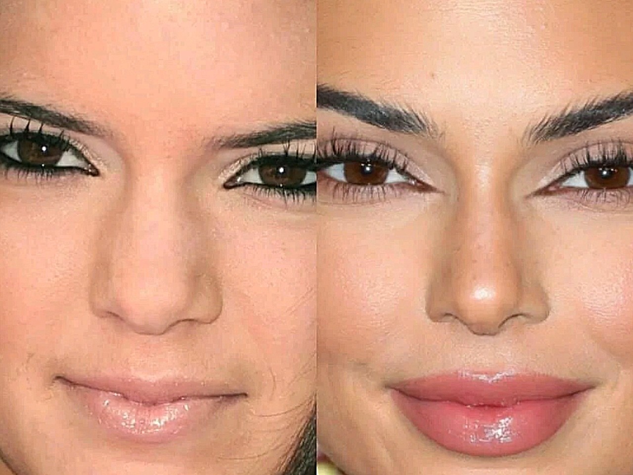 没想到肯豆的颜和身材也都是整出来的!