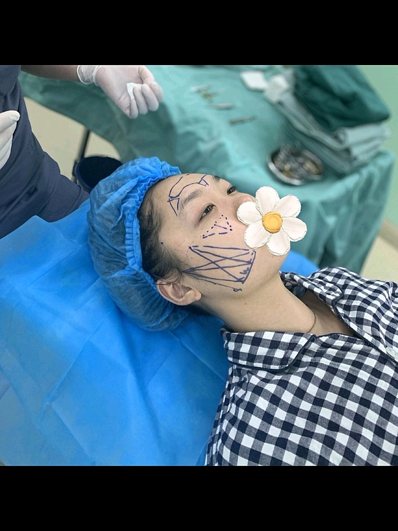 线雕提升和埋线提升的区别