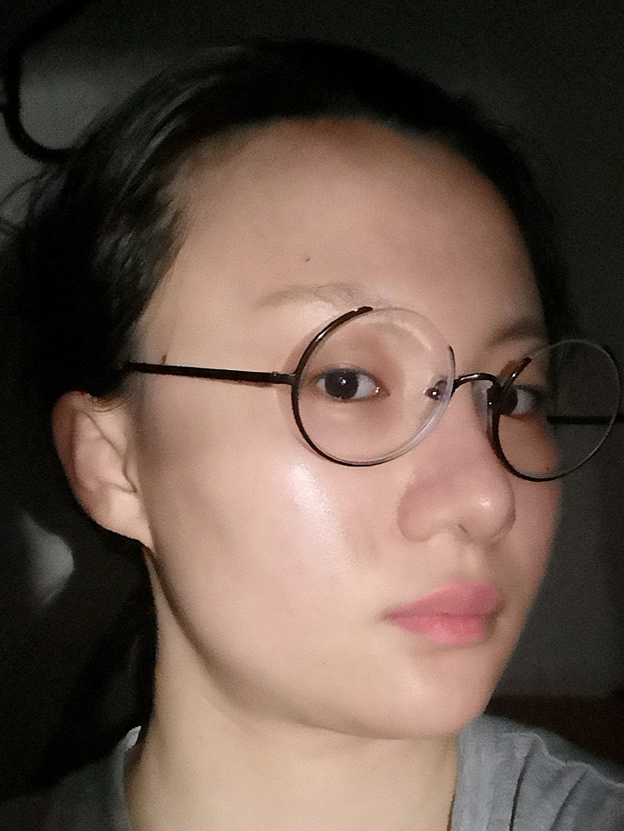 #求看脸打卡睡前一张45度侧脸打卡,求翻牌😉_圈子-新氧美容整形