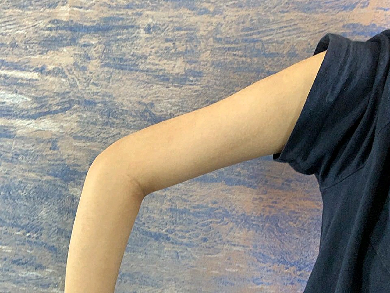 我来打卡啦~已经3个多月了,完全过了恢复期了,现在_圈子-新氧美容整形