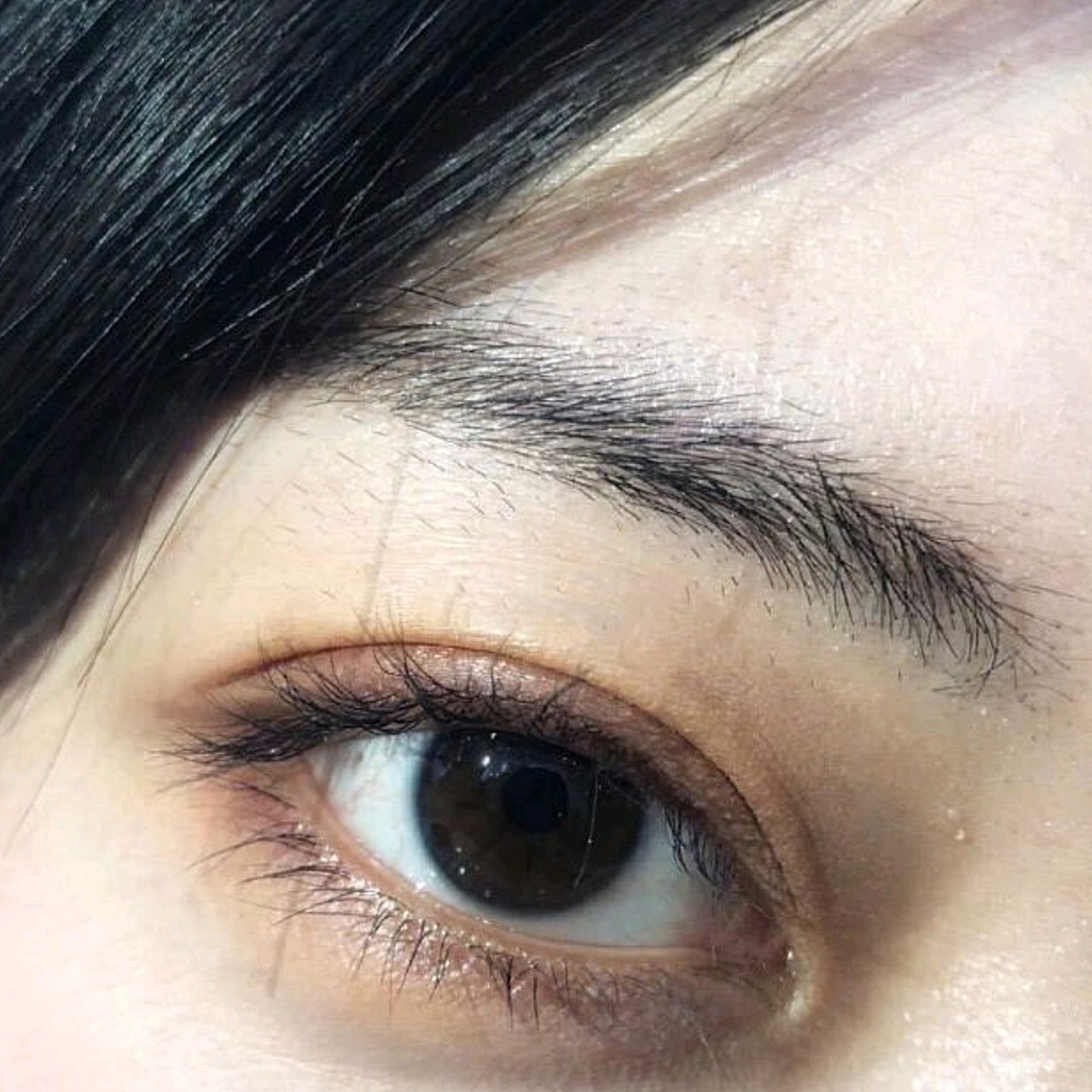 保守选择了开扇形,做完一个月,闭眼有轻微痕迹,还在_圈子-新氧美容