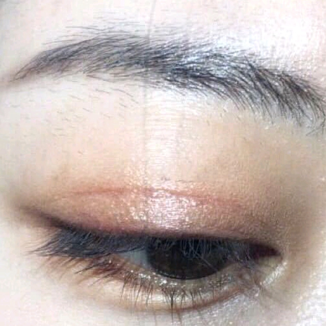 保守选择了开扇形,做完一个月,闭眼有轻微痕迹,还在_圈子-新氧美容