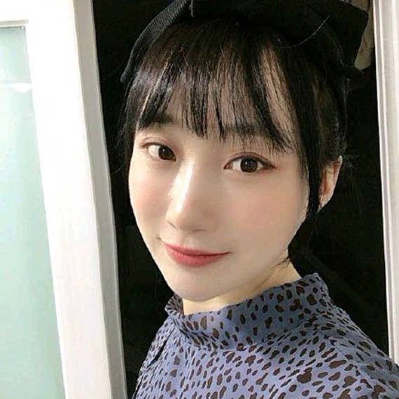 脂肪没有被吸收走掉,精致饱满的脸部是我一直以来的梦_圈子-新氧美容