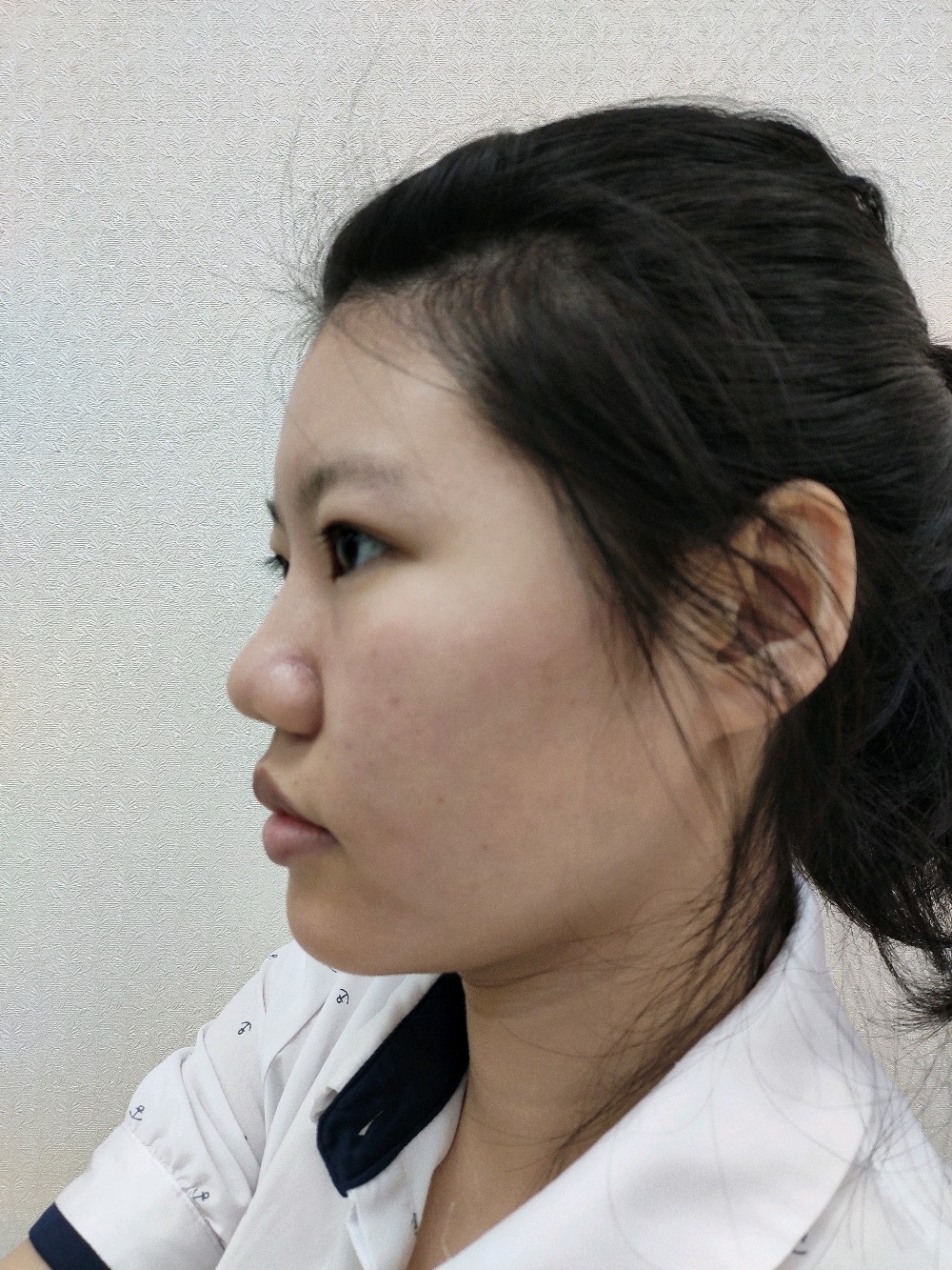 鼻子圆润憨嘴巴太大下颌缘不清晰怎么办