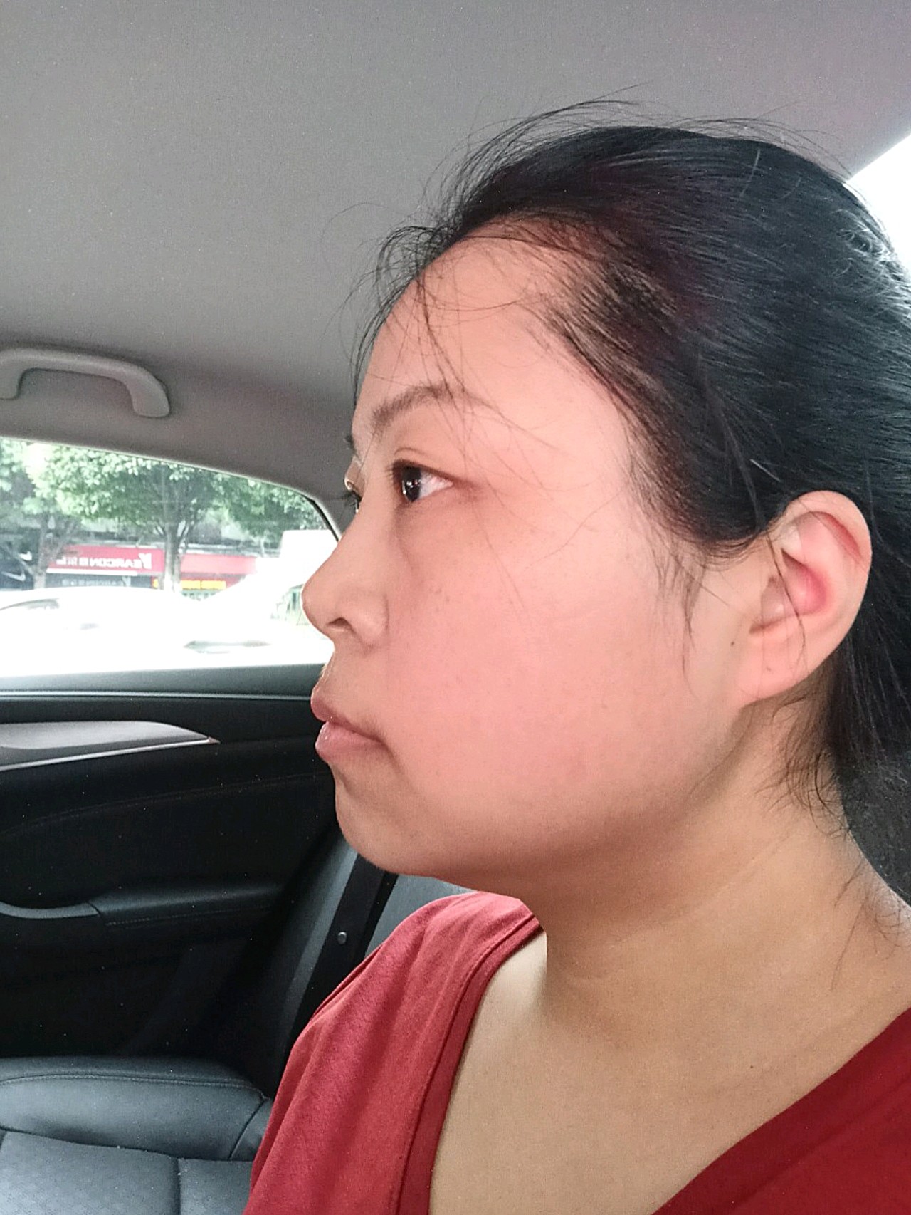 求看脸打卡肤色不均,鼻翼外扩,法令纹明显,下颌角_圈子-新氧美容招挝