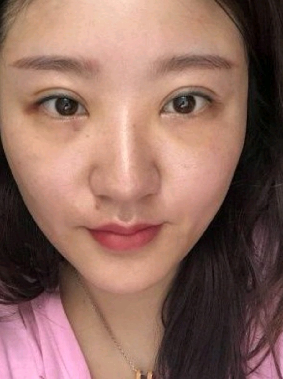 天生眼袋重,青春还没有绽放就先蔫儿了