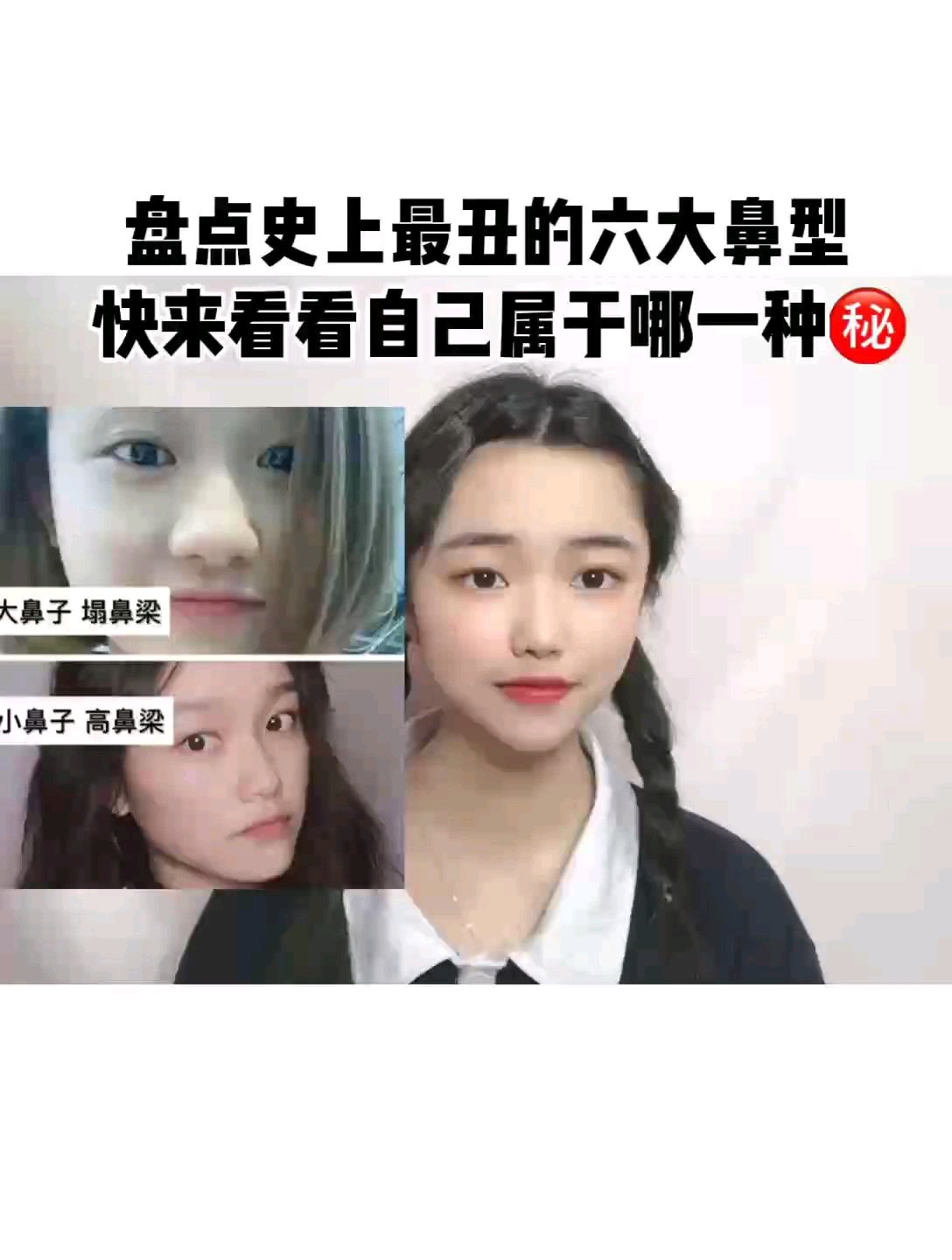 盘点最丑六大鼻型你属于那种呢717171