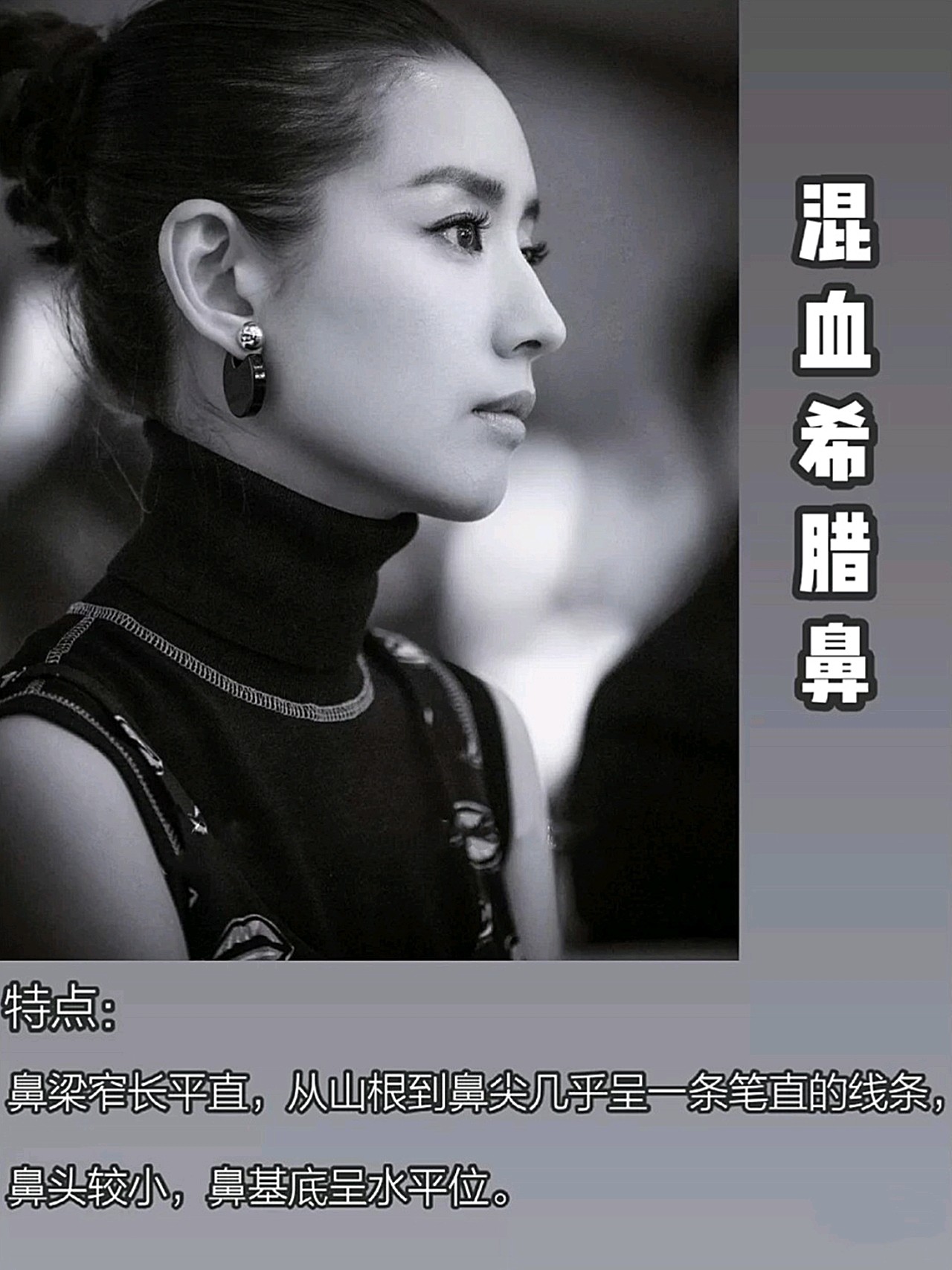 7315日系轻氧鼻特点:山根自然挺拔较细,鼻头精致小巧_圈子-新氧