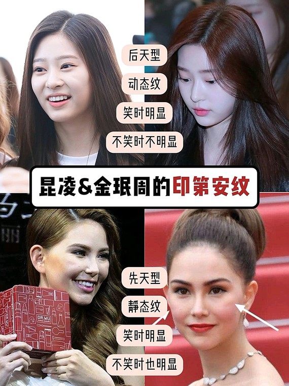 宋茜昆凌脸上的印第安纹最全解决方法60