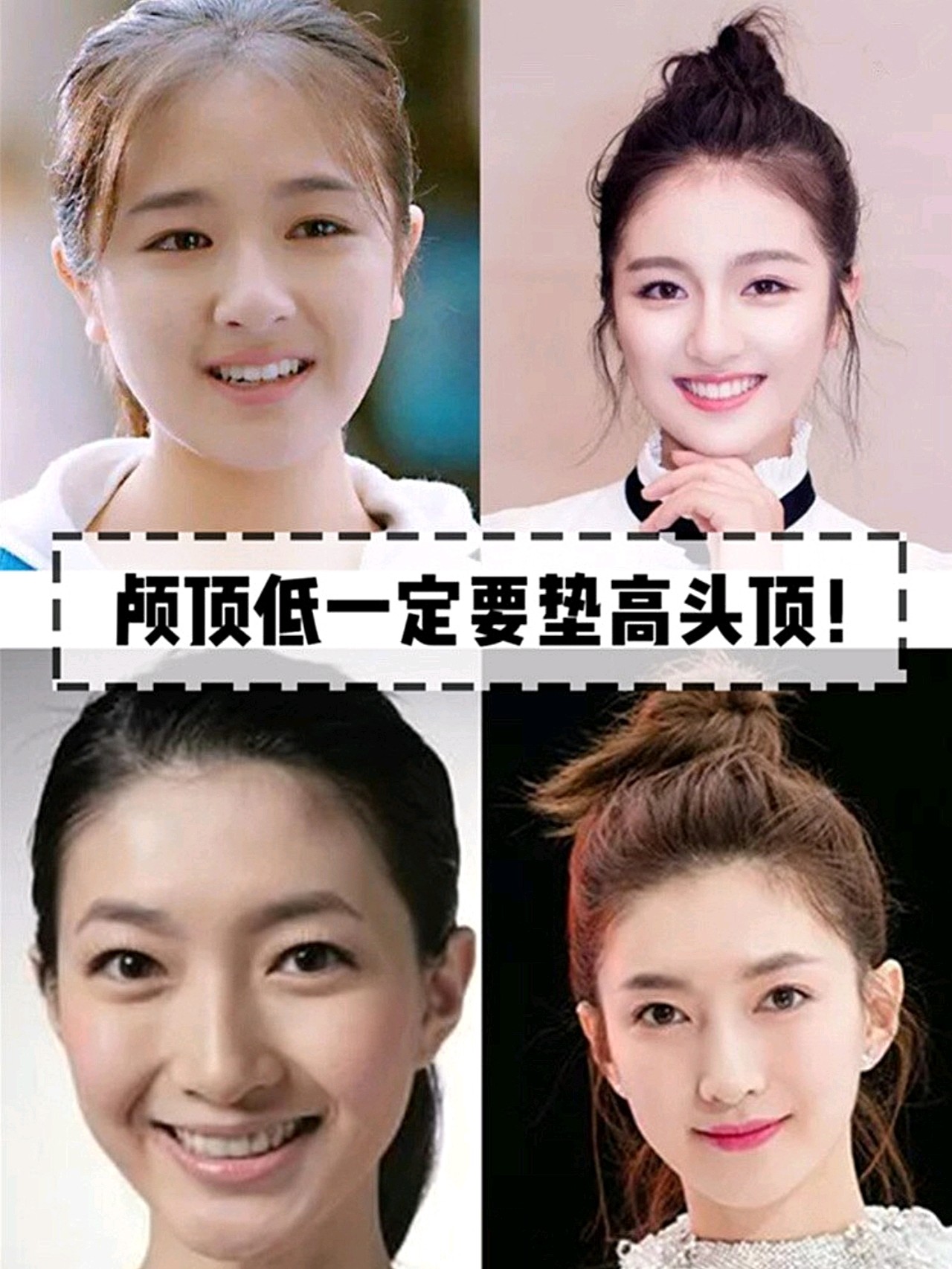 你脸大可能是颅顶低低颅顶女孩自救指南