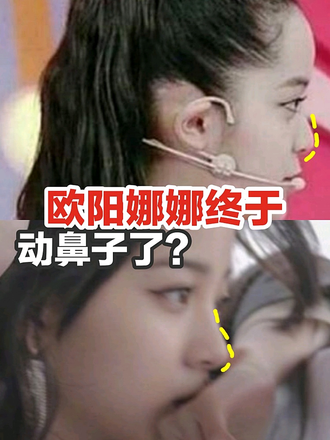欧阳娜娜鼻子怎么变挺了?