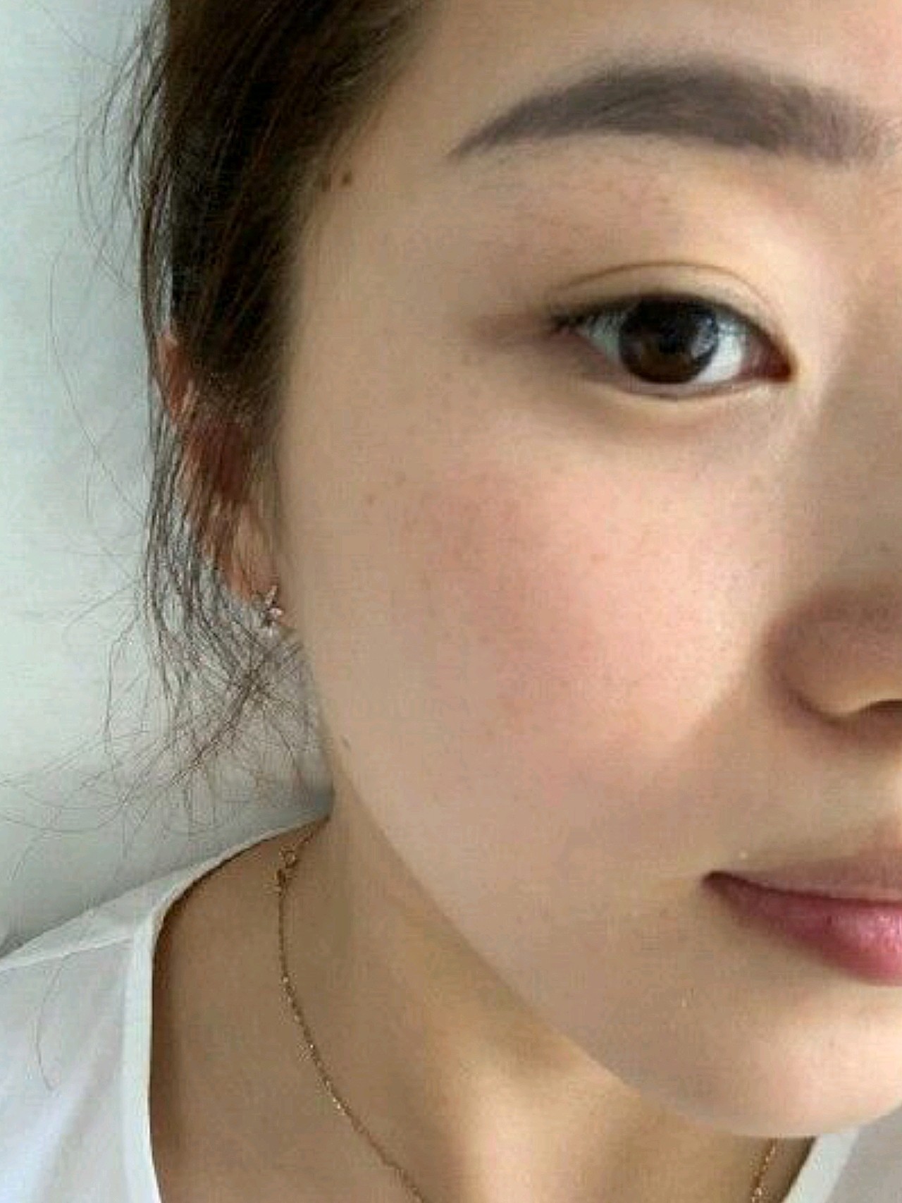 先说一下我的皮肤问题:颧骨和鼻梁位置有一些斑,额头_圈子-新氧美容