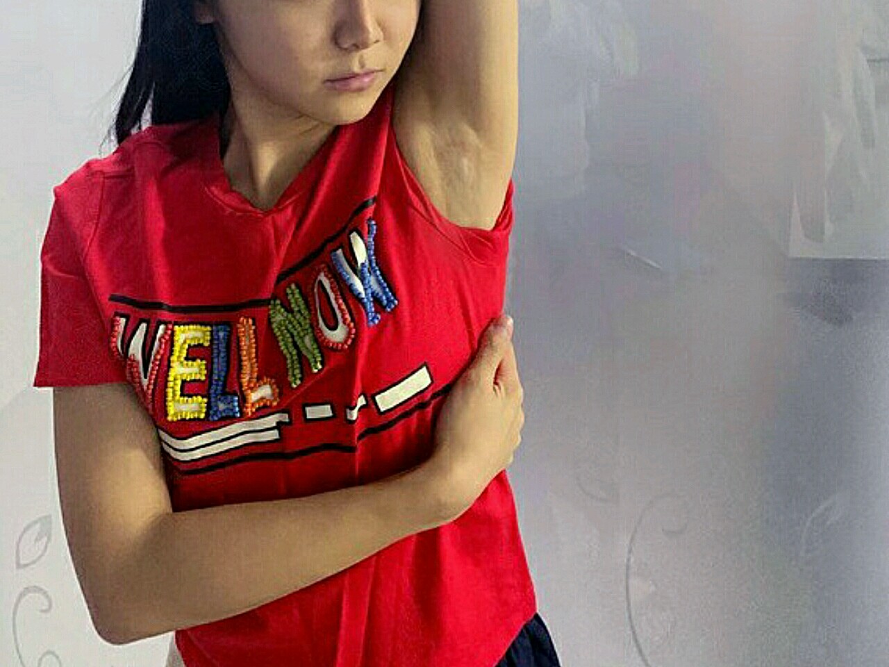 又去做了次修复,腋下疤痕还有一点痕迹,但是颜色和触感跟正常皮肤差不