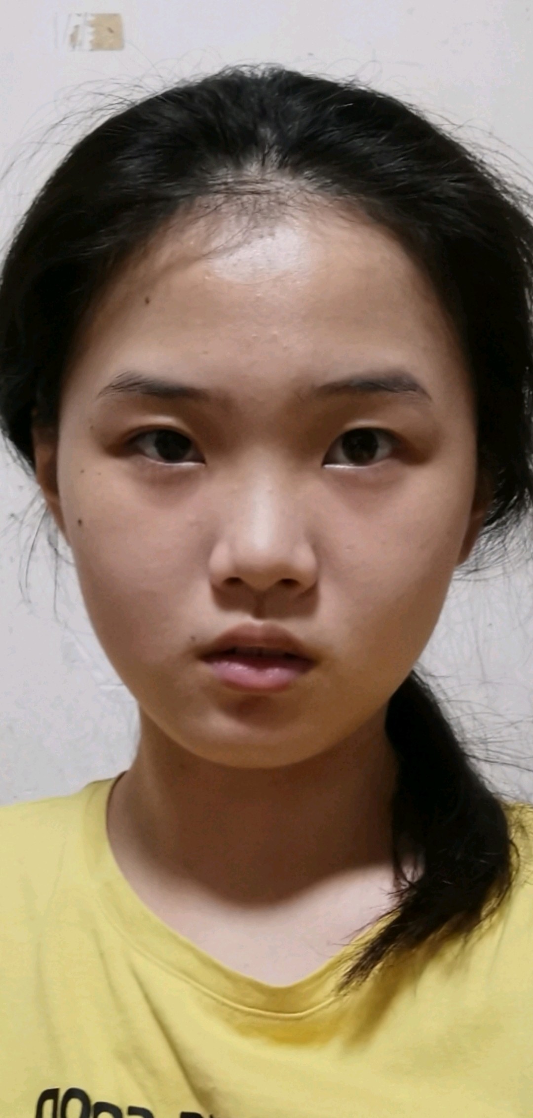 想看适不适合割双眼皮