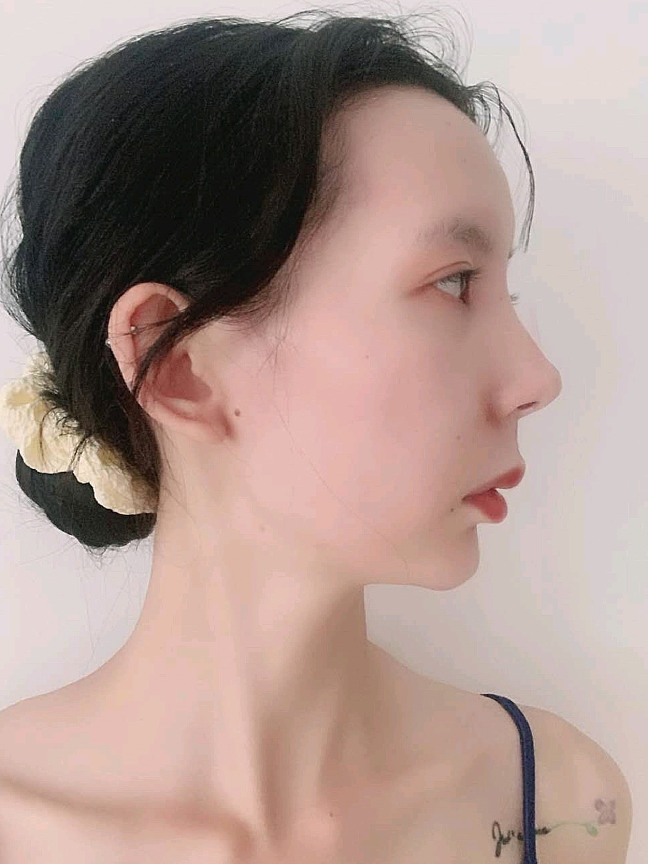 /韩缘聚美—肋骨盒鼻/美好的一天又开始啦,今天也是_圈子-新氧美容整