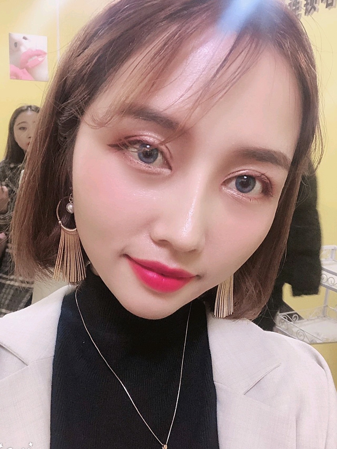 显微芭比双眼皮耳软骨隆鼻术后祩54天